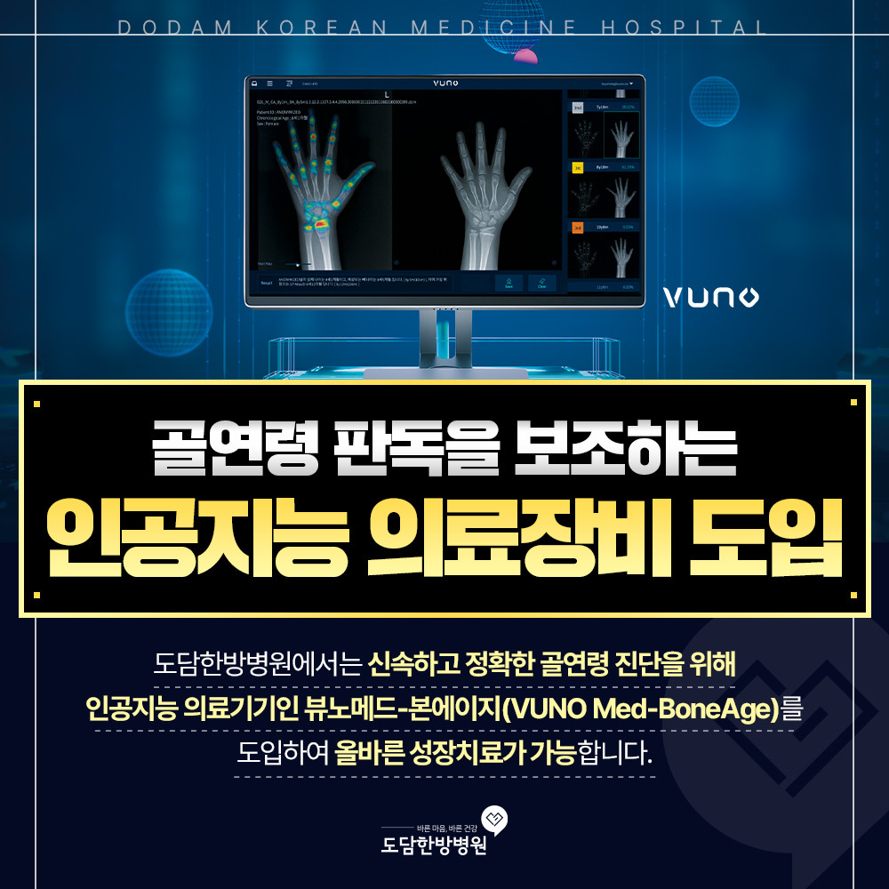 인공지능 의료장비 도입