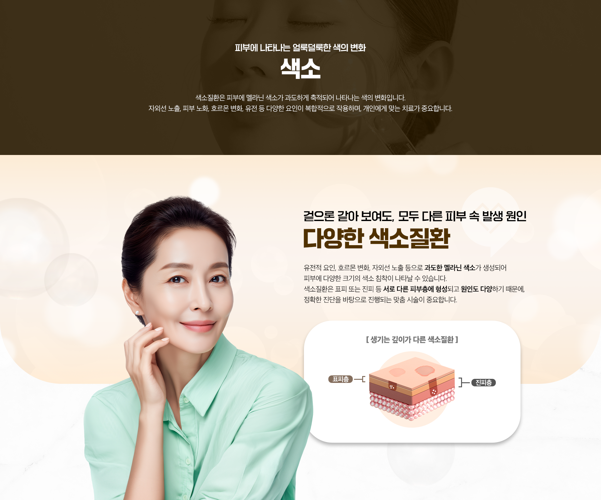 피부에 나타나는 얼룩덜룩한 색의 변화-색소-겉으론 같아 보여도, 모두 다른 피부 속 발생 원인-다양한 색소질환