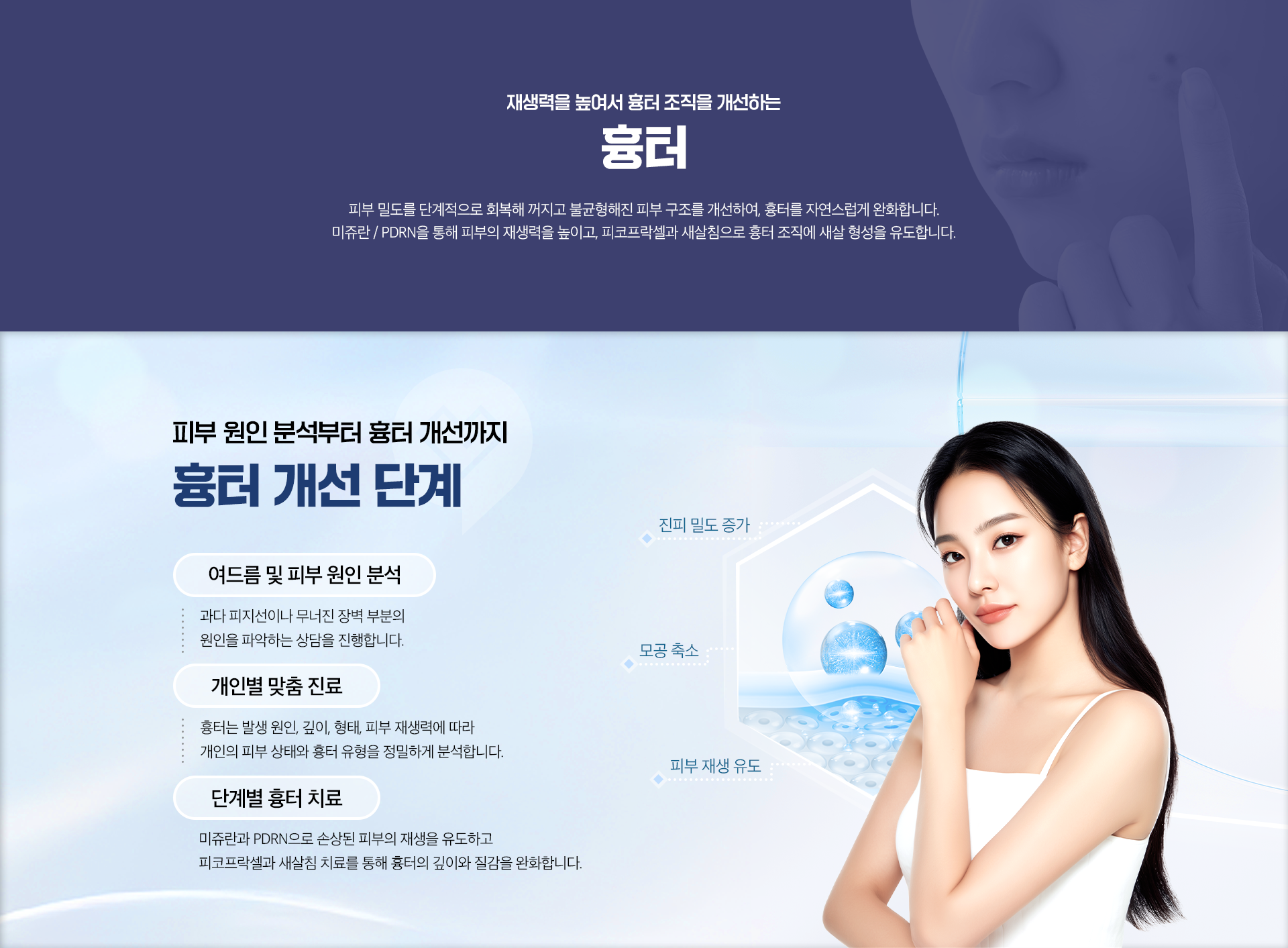 재생력을 높여서 흉터 조직을 개선하는-흉터-피부 원인 분석부터 흉터 개선까지-흉터 개선 단계-여드름 및 피부 원인 분석, 개인별 맞춤 진료, 단계별 흉터 치료